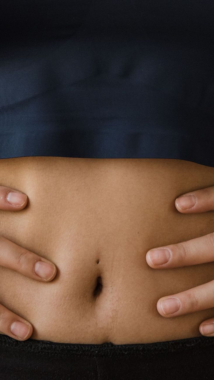 Femme tenant son ventre gonflé, soulagée grâce à la luxopuncture contre les ballonnements